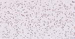 H3K28ac Antibody in Immunohistochemistry (Paraffin) (IHC (P))