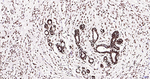 H3K28ac Antibody in Immunohistochemistry (Paraffin) (IHC (P))