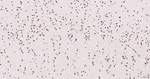 H3K28ac Antibody in Immunohistochemistry (Paraffin) (IHC (P))
