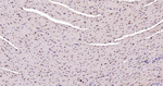 H3K28ac Antibody in Immunohistochemistry (Paraffin) (IHC (P))
