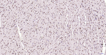 H3K28ac Antibody in Immunohistochemistry (Paraffin) (IHC (P))