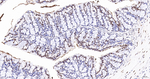SNRPA1 Antibody in Immunohistochemistry (Paraffin) (IHC (P))