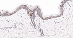 SNRPA1 Antibody in Immunohistochemistry (Paraffin) (IHC (P))