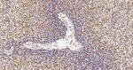 SNRPA1 Antibody in Immunohistochemistry (Paraffin) (IHC (P))