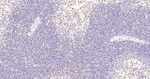SNRPA1 Antibody in Immunohistochemistry (Paraffin) (IHC (P))