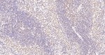 SNRPA1 Antibody in Immunohistochemistry (Paraffin) (IHC (P))