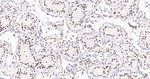 SNRPA1 Antibody in Immunohistochemistry (Paraffin) (IHC (P))