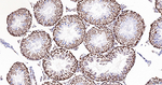 SNRPA1 Antibody in Immunohistochemistry (Paraffin) (IHC (P))
