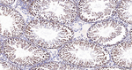 SNRPA1 Antibody in Immunohistochemistry (Paraffin) (IHC (P))