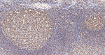 SNRPA1 Antibody in Immunohistochemistry (Paraffin) (IHC (P))