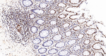SNRPA1 Antibody in Immunohistochemistry (Paraffin) (IHC (P))