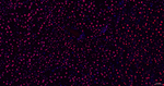 SNRPA1 Antibody in Immunohistochemistry (Paraffin) (IHC (P))