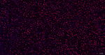 SNRPA1 Antibody in Immunohistochemistry (Paraffin) (IHC (P))