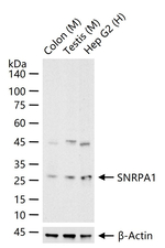 SNRPA1 Antibody in Western Blot (WB)