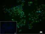 ACAA2 Recombinant Rabbit Monoclonal Antibody (11G2)