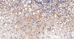 ACAA2 Antibody in Immunohistochemistry (Paraffin) (IHC (P))