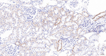 ACAA2 Antibody in Immunohistochemistry (Paraffin) (IHC (P))