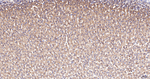 ACAA2 Antibody in Immunohistochemistry (Paraffin) (IHC (P))