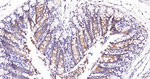ACAA2 Antibody in Immunohistochemistry (Paraffin) (IHC (P))
