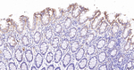 ACAA2 Antibody in Immunohistochemistry (Paraffin) (IHC (P))