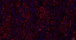 ACAA2 Antibody in Immunohistochemistry (Paraffin) (IHC (P))
