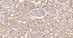 ACAA2 Antibody in Immunohistochemistry (Paraffin) (IHC (P))