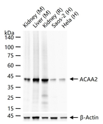 ACAA2 Antibody in Western Blot (WB)