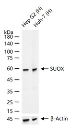 SUOX Antibody in Western Blot (WB)