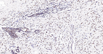 BRMS1 Antibody in Immunohistochemistry (Paraffin) (IHC (P))