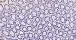 BRMS1 Antibody in Immunohistochemistry (Paraffin) (IHC (P))