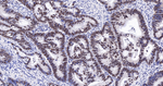 BRMS1 Antibody in Immunohistochemistry (Paraffin) (IHC (P))