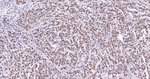 BRMS1 Antibody in Immunohistochemistry (Paraffin) (IHC (P))