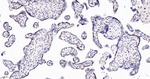 BRMS1 Antibody in Immunohistochemistry (Paraffin) (IHC (P))