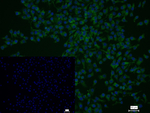 ERLIN2 Recombinant Rabbit Monoclonal Antibody (8C8)