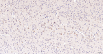 ERLIN2 Antibody in Immunohistochemistry (Paraffin) (IHC (P))