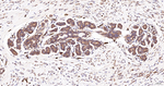 ERLIN2 Antibody in Immunohistochemistry (Paraffin) (IHC (P))