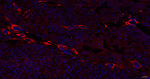 ERLIN2 Antibody in Immunohistochemistry (Paraffin) (IHC (P))