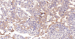 ERLIN2 Antibody in Immunohistochemistry (Paraffin) (IHC (P))