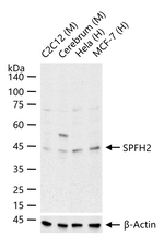 ERLIN2 Antibody in Western Blot (WB)