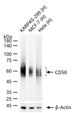 CD58 Recombinant Rabbit Monoclonal Antibody (12B1)