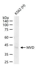 MVD Recombinant Rabbit Monoclonal Antibody (12E3)