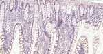 TNFRSF11B Recombinant Rabbit Monoclonal Antibody (2G14)