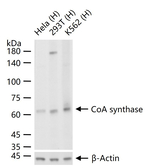 CoA Synthase Recombinant Rabbit Monoclonal Antibody (10A4)