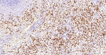 NCF4 Antibody in Immunohistochemistry (Paraffin) (IHC (P))