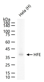 HFE Recombinant Rabbit Monoclonal Antibody (7G10)
