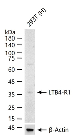 LTB4R Recombinant Rabbit Monoclonal Antibody (12C4)
