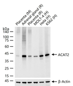 ACAT2 Antibody in Western Blot (WB)