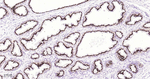 Prostein Recombinant Rabbit Monoclonal Antibody (8H3)