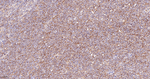 CD84 Antibody in Immunohistochemistry (Paraffin) (IHC (P))
