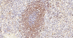 CD84 Antibody in Immunohistochemistry (Paraffin) (IHC (P))